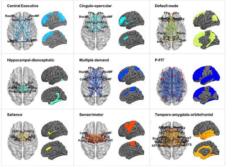 Brain Networks of interest